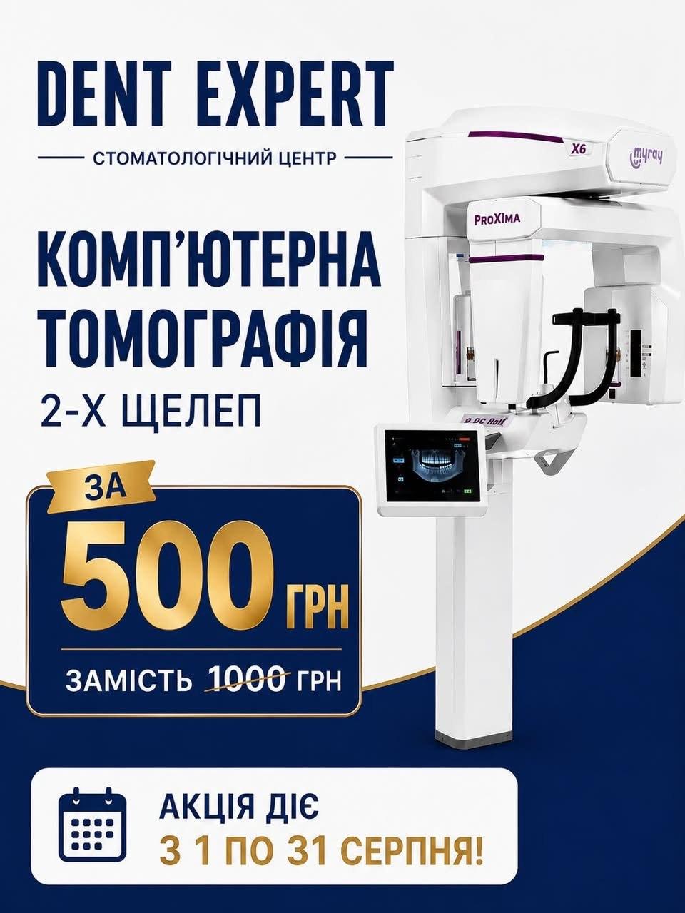 Компьютерная томография 2-х челюстей за 500 грн вместо 1000 грн — акция с 1 по 31 августа